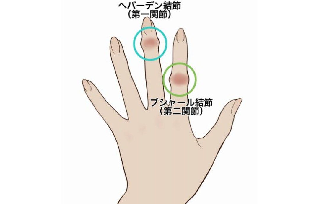 指のケアのイメージ